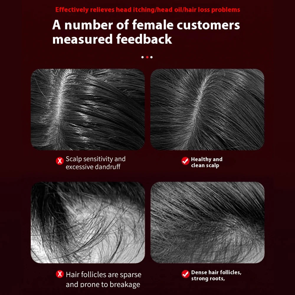 Red Light Scalp Therapy electric Massage Comb